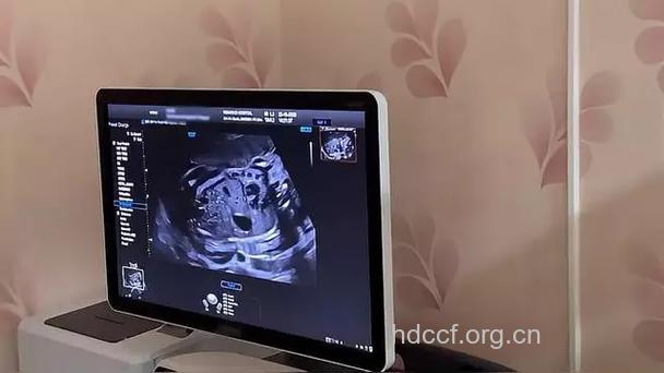 怀孕多久做早孕B超检查安全