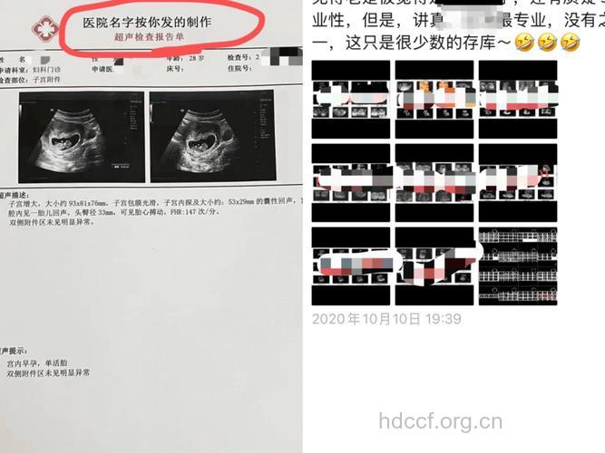 怎样看孕期B超检查单