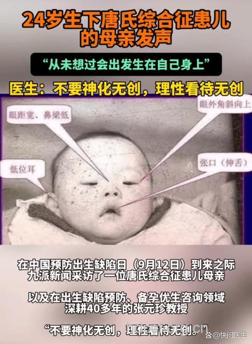孕妇在什么情况下容易生下唐氏儿?