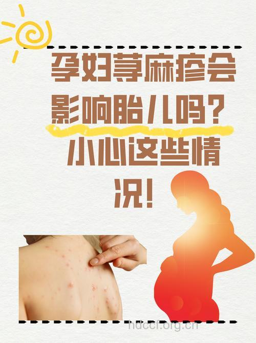 夏季过敏高发 孕妈妈需注意