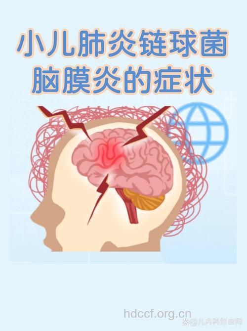 小儿肺炎链球菌脑膜炎的病因