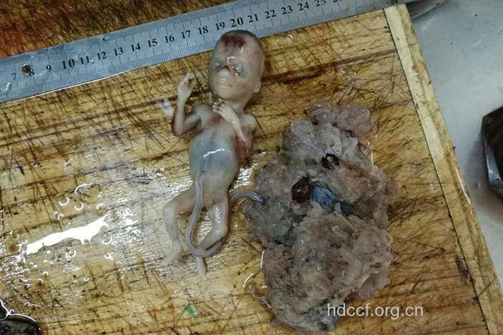 葡萄胎是什么?葡萄胎早期症状!