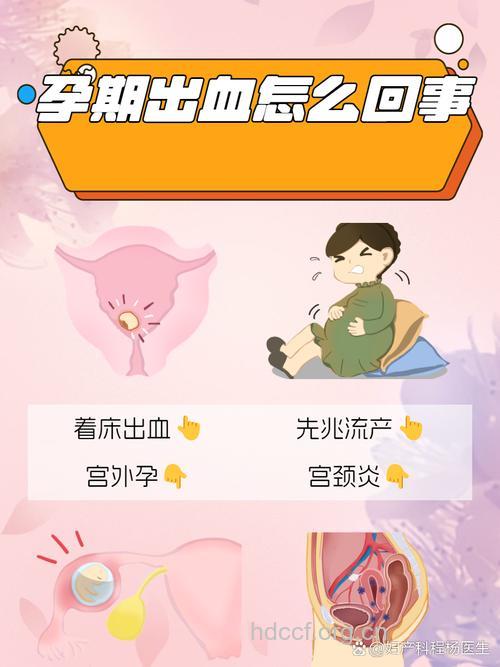 孕期出血几个处理措施 让孕妈妈不再慌张!