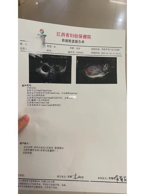 孕期疾病 葡萄胎清宫后须追踪检查