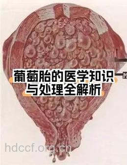 注意!葡萄胎治疗后要做X光检查