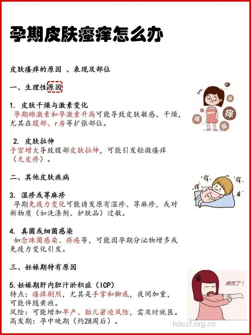 孕妇妊娠瘙痒症防治方法