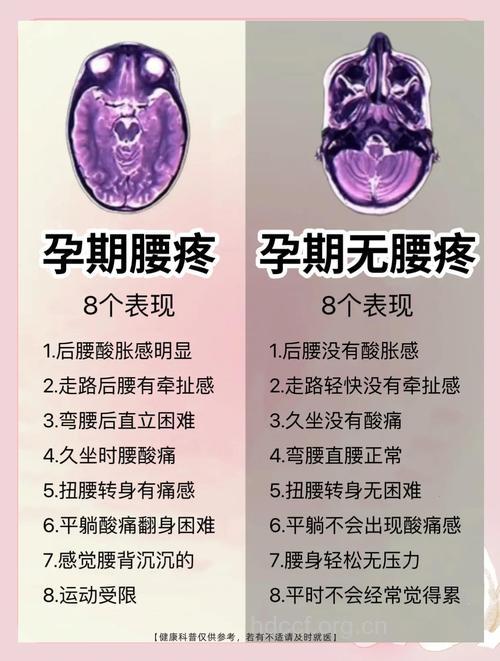 缓解孕早期腰疼 遵循11个保养原则