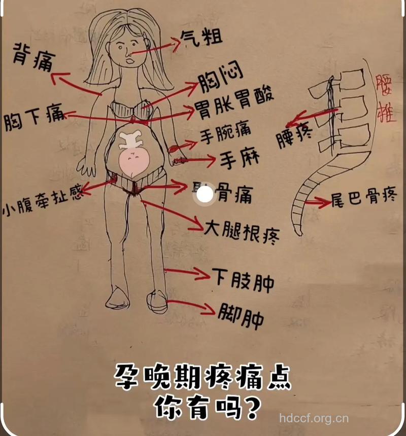 盘点孕期会出现的7大疼痛