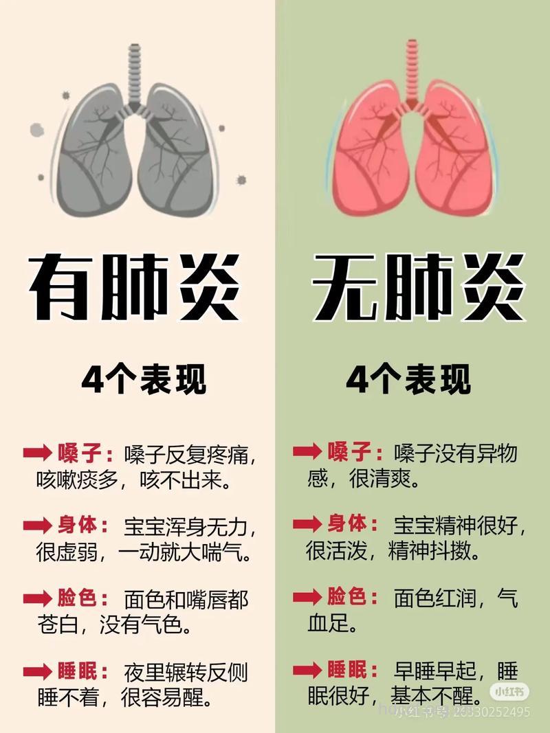 春季宝宝肺炎应该怎么办