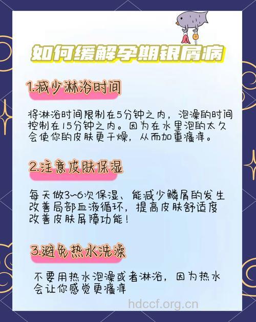 孕妇牛皮癣应该怎么办