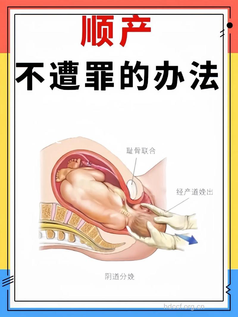 产妇对自然分娩的误解有哪些