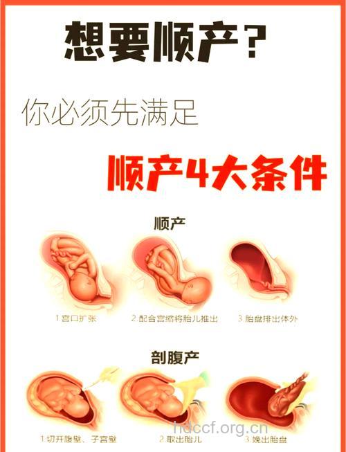 决定孕妇顺产的4大条件