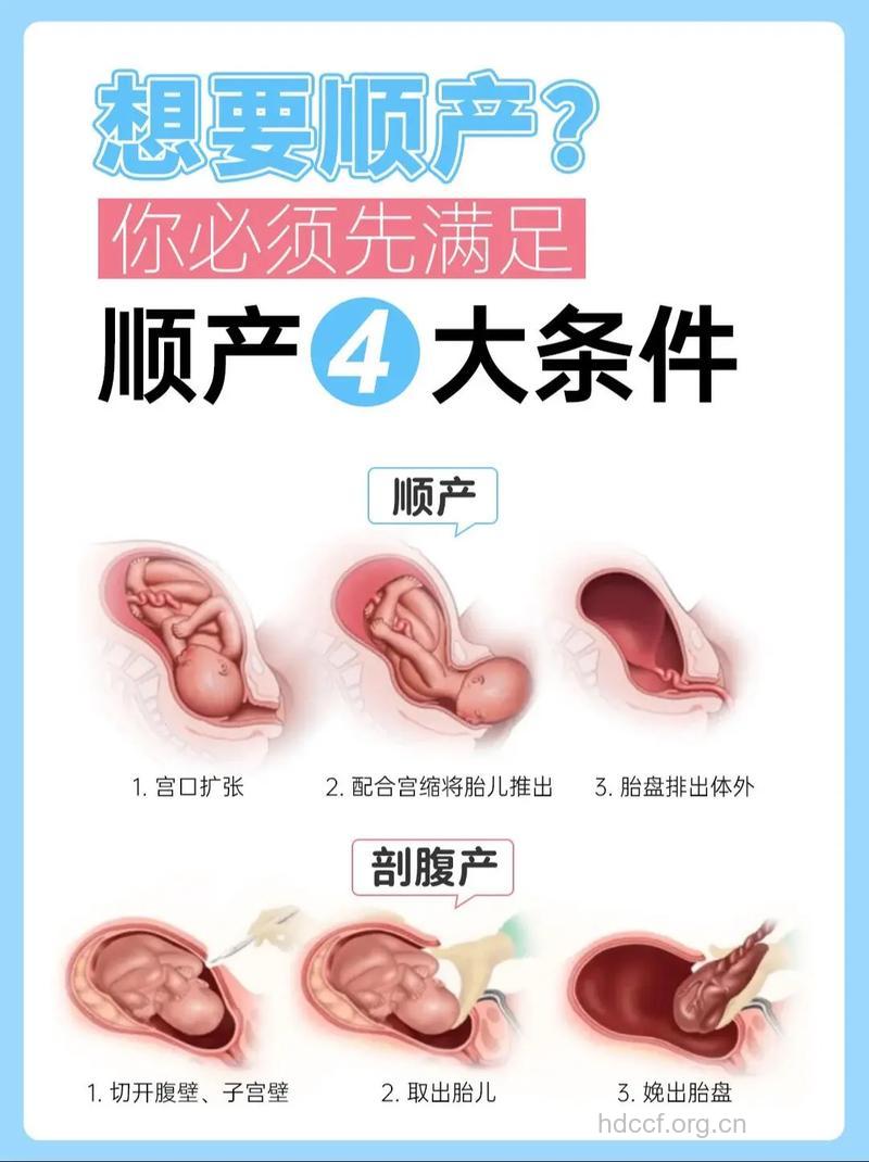 怎样做能顺产 顺产的4大条件