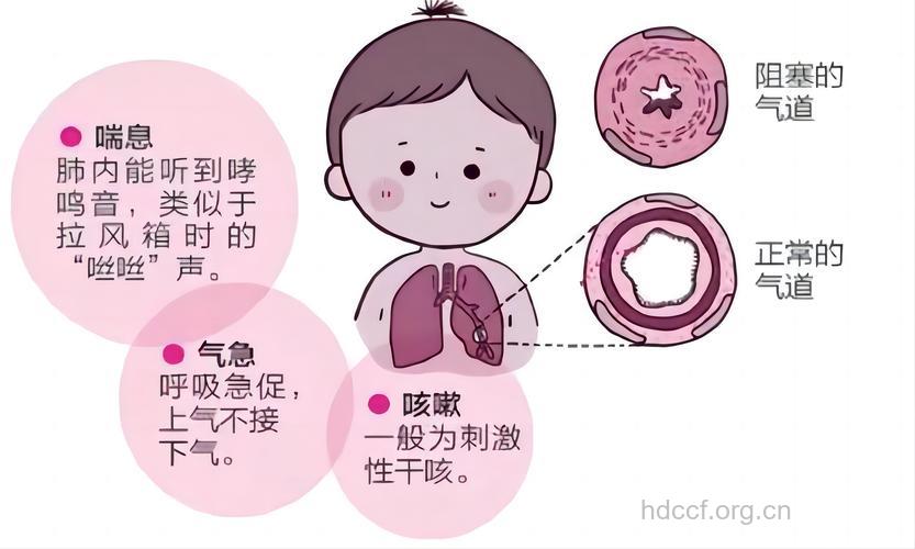婴儿哮喘有什么症状及预防