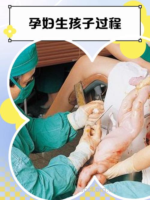 夏季孕妇分娩前的11个准备