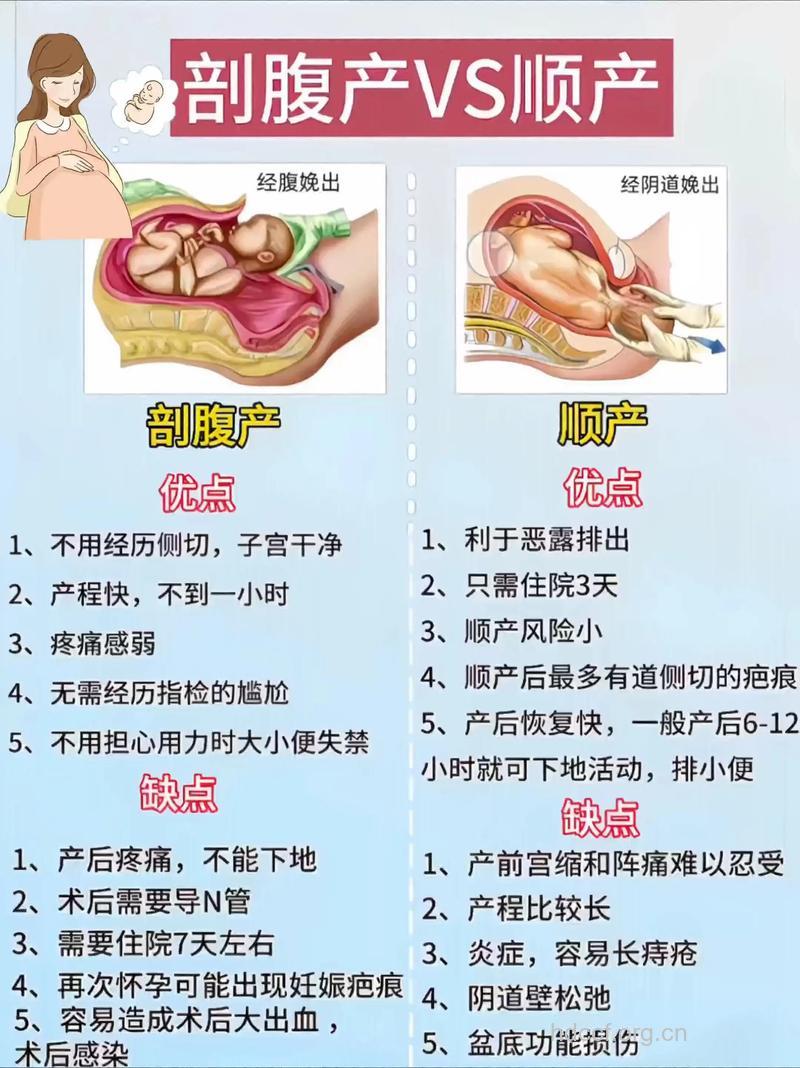 分娩时顺产是否比剖腹产好呢