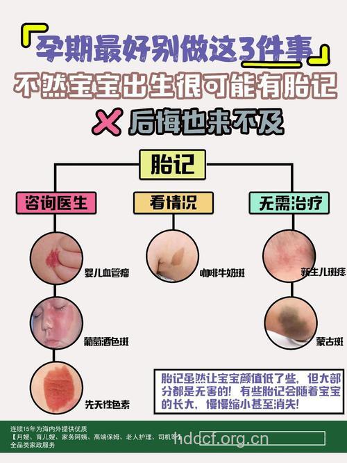 孕期注意四大事项 小心宝宝会有胎记