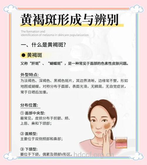 女人如何吃掉孕期黄褐斑