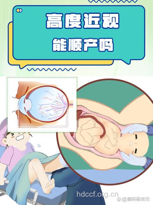 孕妇高度近视可以选择顺产吗