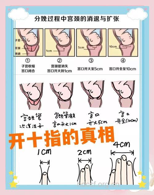 产前小科普 什么是开十指