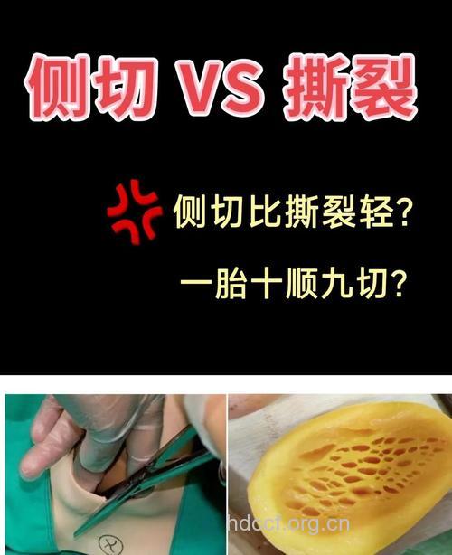 产伤有哪几种