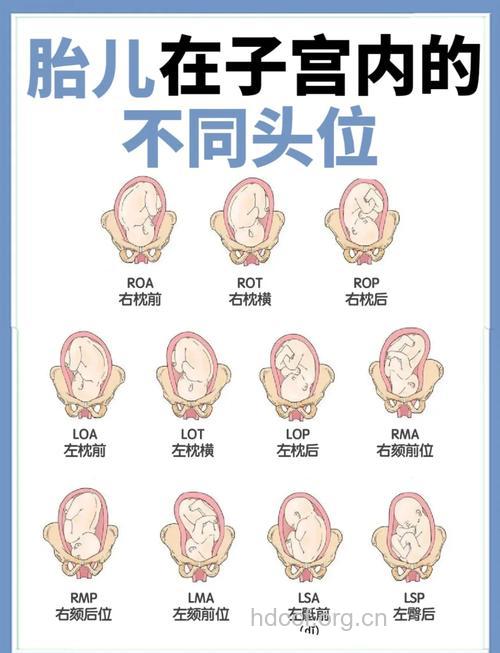 揭秘胎儿容易难产的胎位