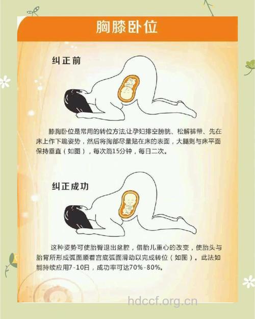 胎儿臀位分娩怎么做