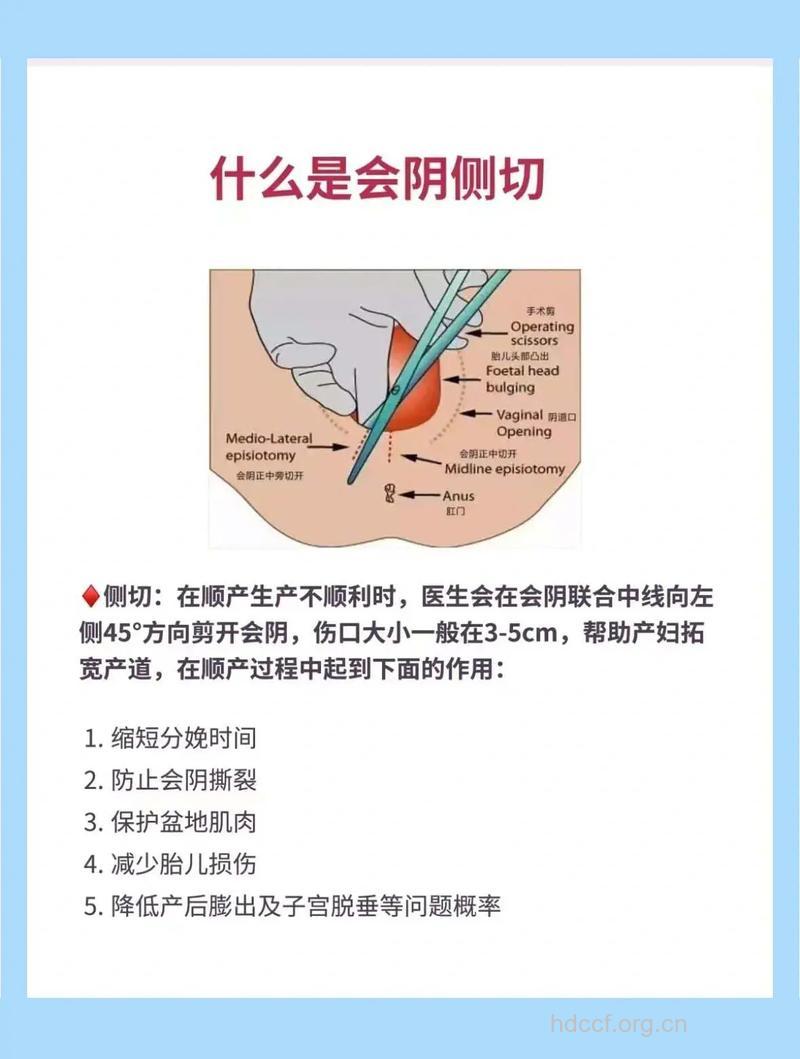 顺产还得挨一刀 私处如何免一刀