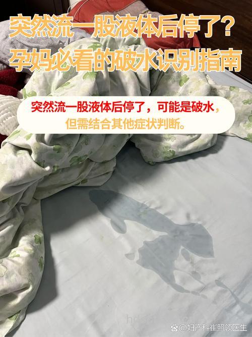 真正破水的情况是怎么样的？