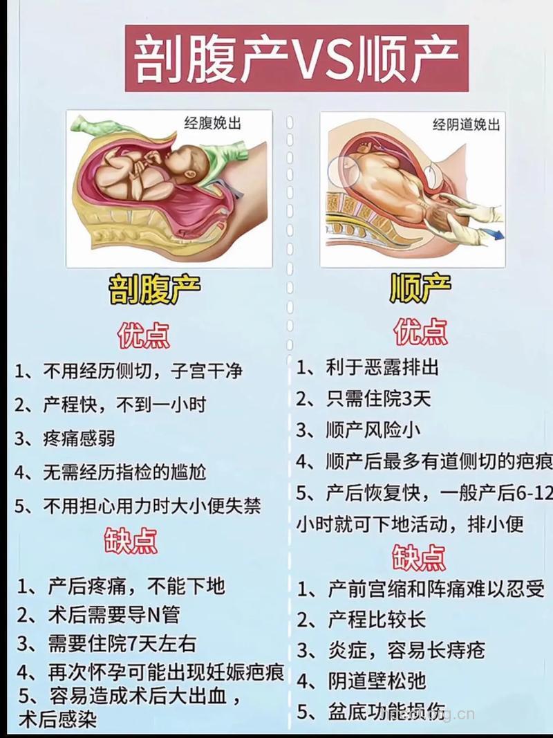盘点顺产的好处与坏处