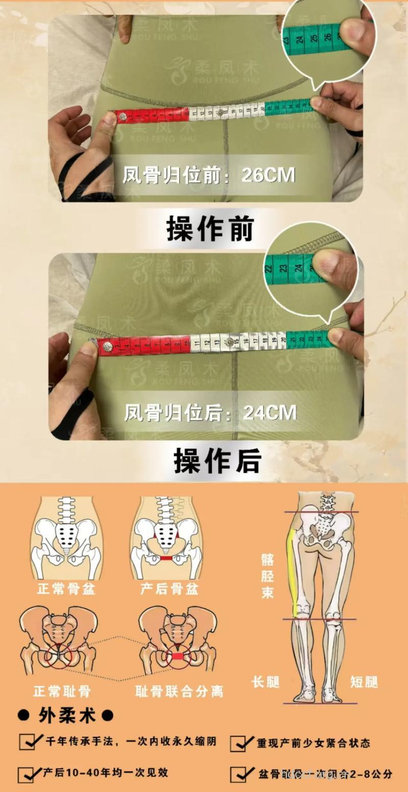 临产前 孕妇该如何进行骨盆测量