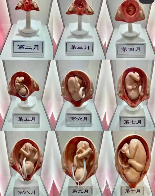 图示胎位 怀孕20周胎儿胎位图