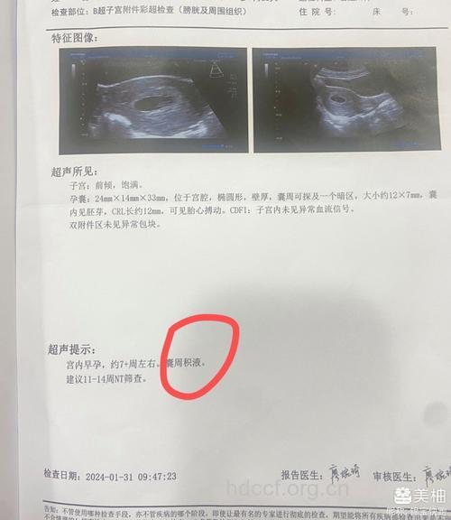 怀孕193天