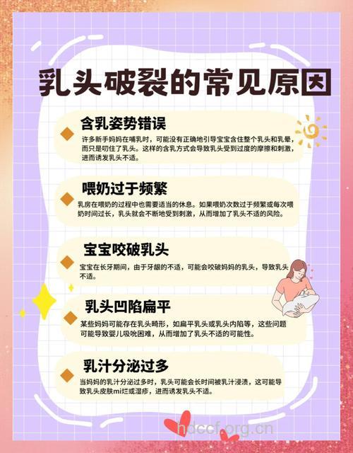 哺乳期奶漏怎么办 喂奶时要注意这些