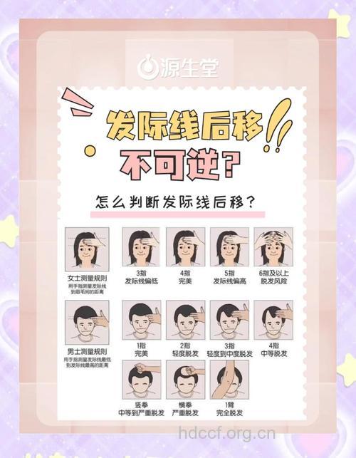 生完娃后发际线越来越高 该怎么办