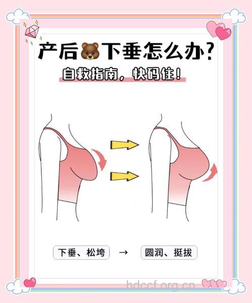 产后胸部下垂怎么办 试试这些保养方法