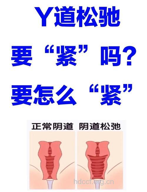 顺产后下面会松弛吗 产后缩阴有妙招