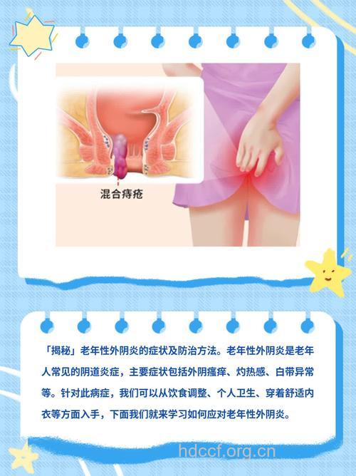 外阴炎