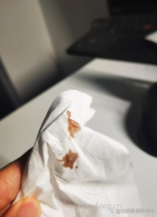 吃了避孕药出血