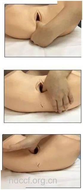 顺产后阴道疼痛怎么办 缓解疼痛方法介绍