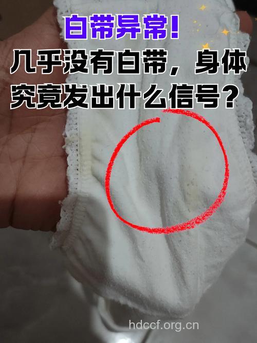 白带不拉丝