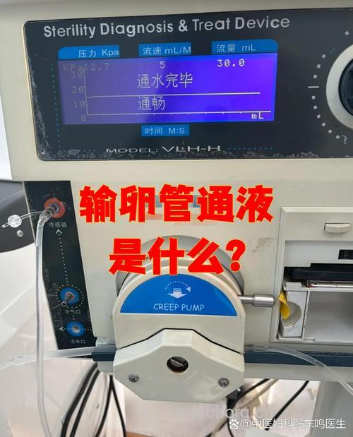 输卵管通水