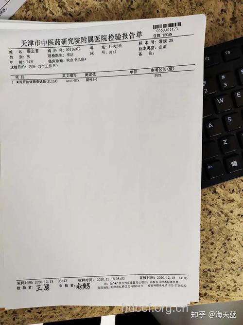 丙肝抗体检测