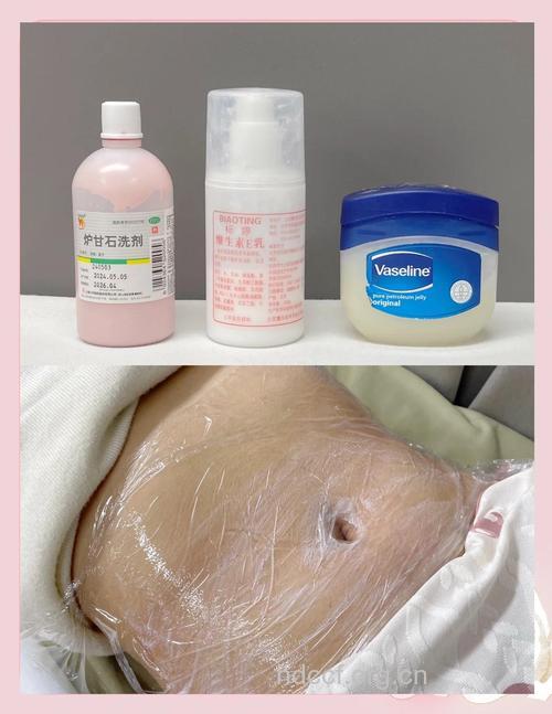 产后消除妊娠纹 这样吃就可以