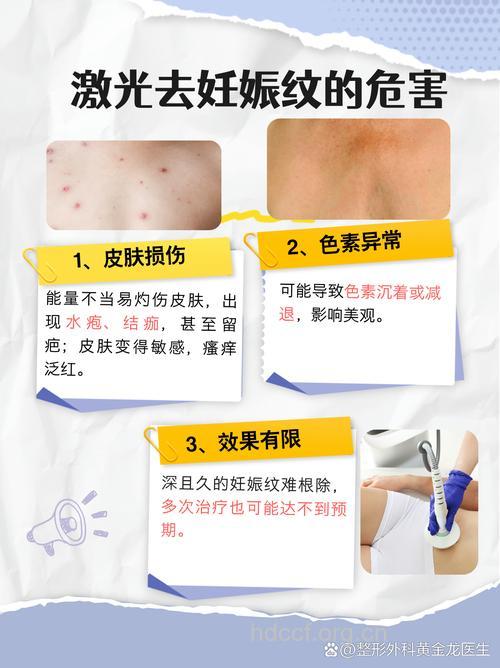 激光消除妊娠纹会有副作用吗