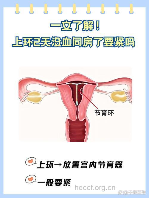 上环清宫可以一起吗 上环的副作用多