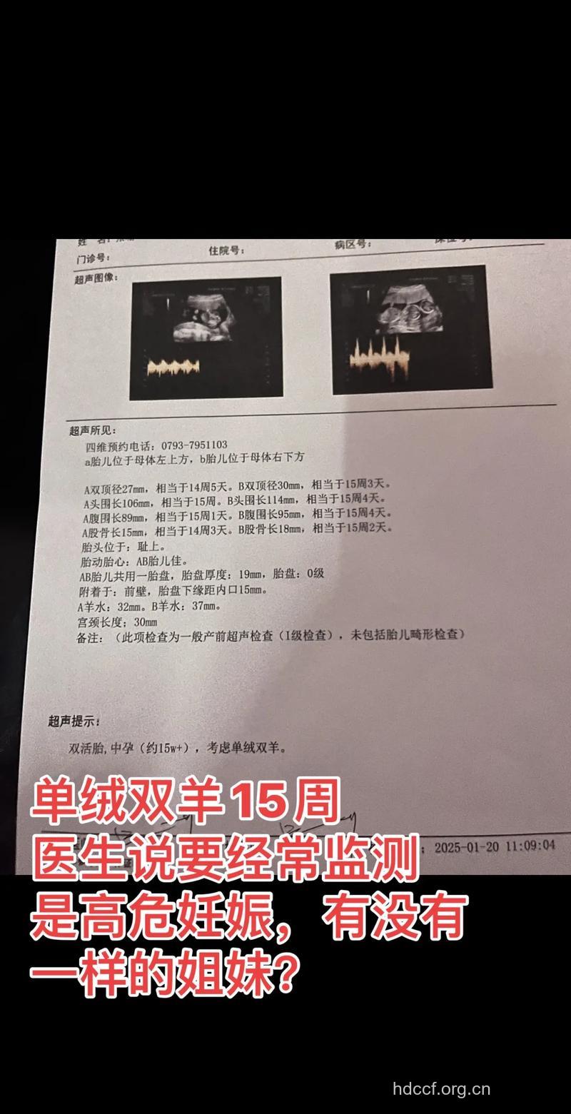怀孕15周