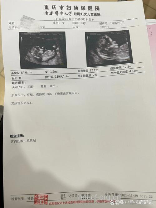怀孕12周