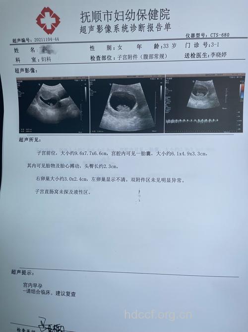 怀孕10周