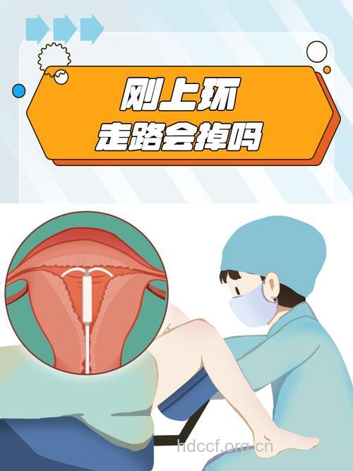 带环避孕的原理是什么